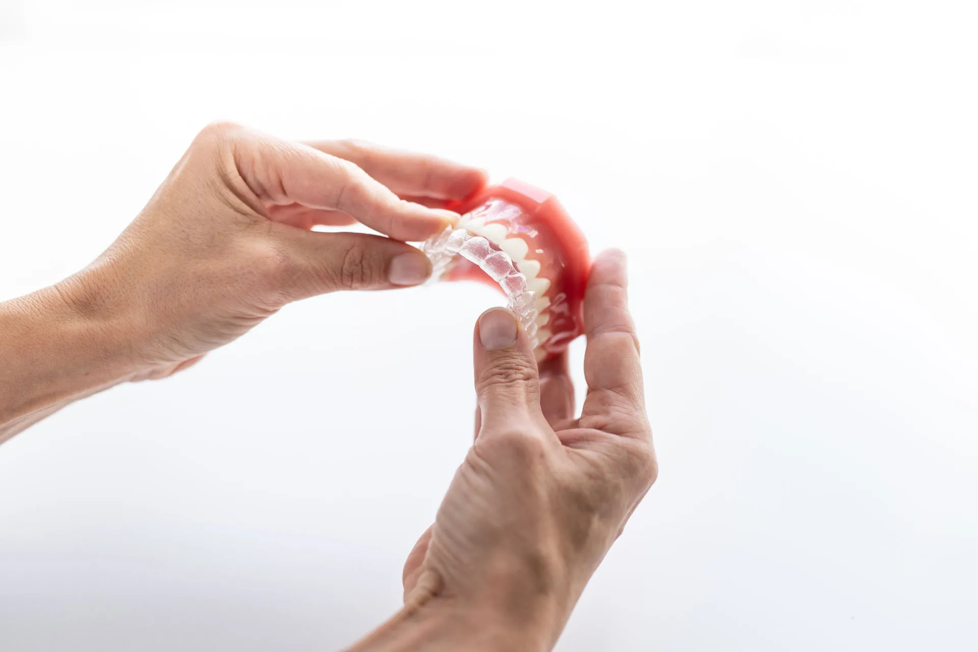 Tandlæge viser hvordan Invisalign skinner til tandregulering sættes på tænderne.